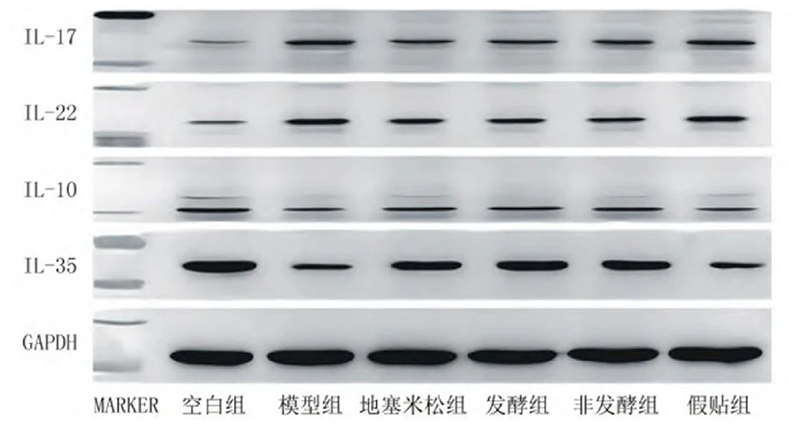 空白組和支氣管哮喘各組大鼠肺組織中IL－17、IL－22、IL－10、IL－35蛋白表達(dá)電泳圖